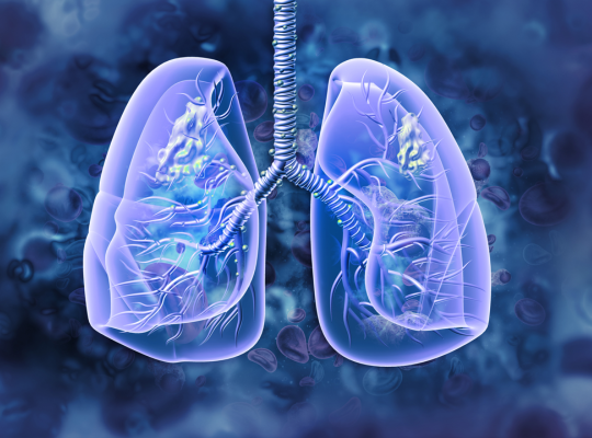 Lung Cancer Surgeons in UAE