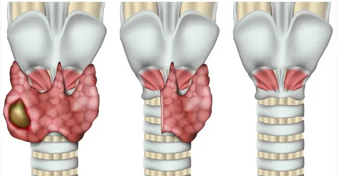 What Is Thyroid Cancer Surgery and How Does It Work?