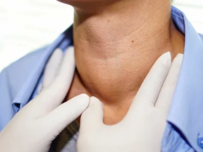 thyroid cancer treatment